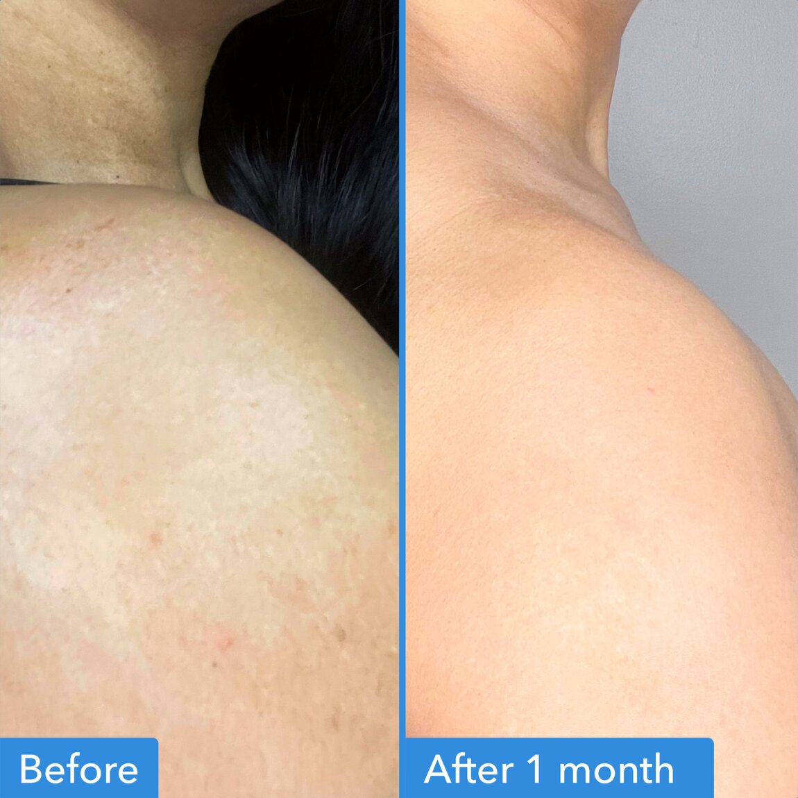 discoloration-correcting-body-treatment-i0 zb_p.jpg