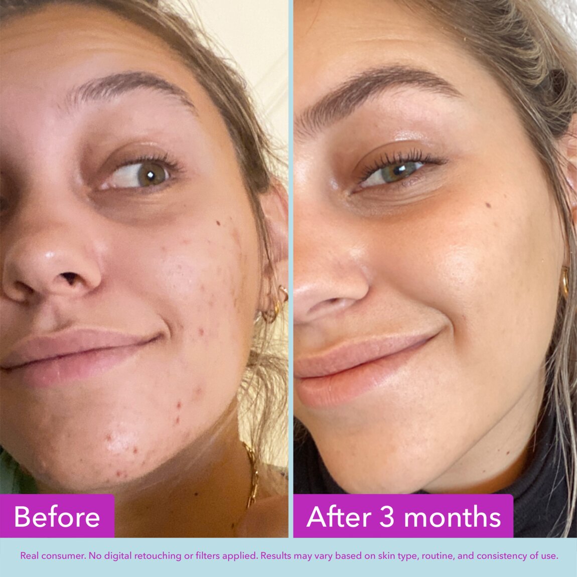 niacinamide-brightening-toner-m0 zb_p.jpg