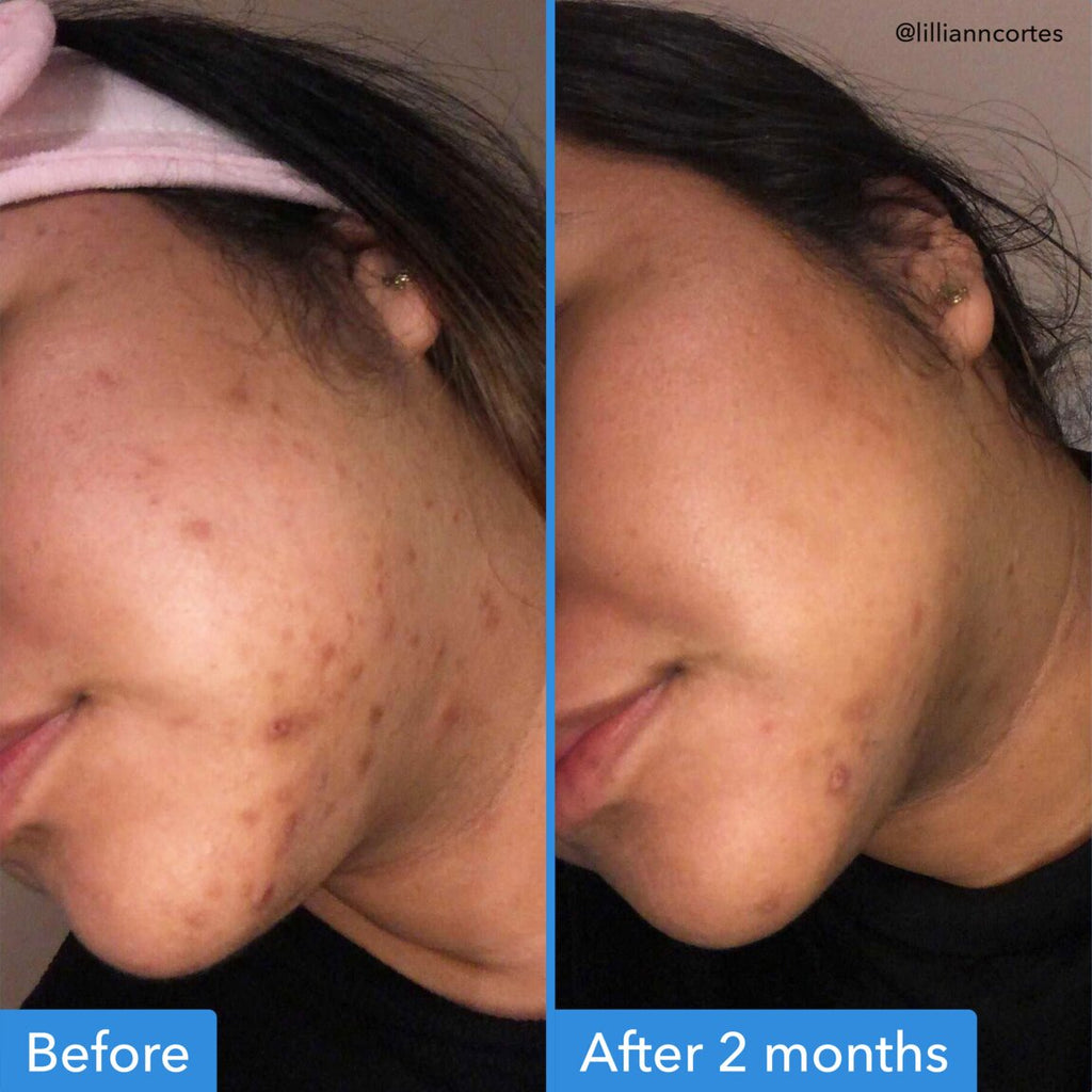 discoloration-correcting-serum-y4 zb_p.jpg