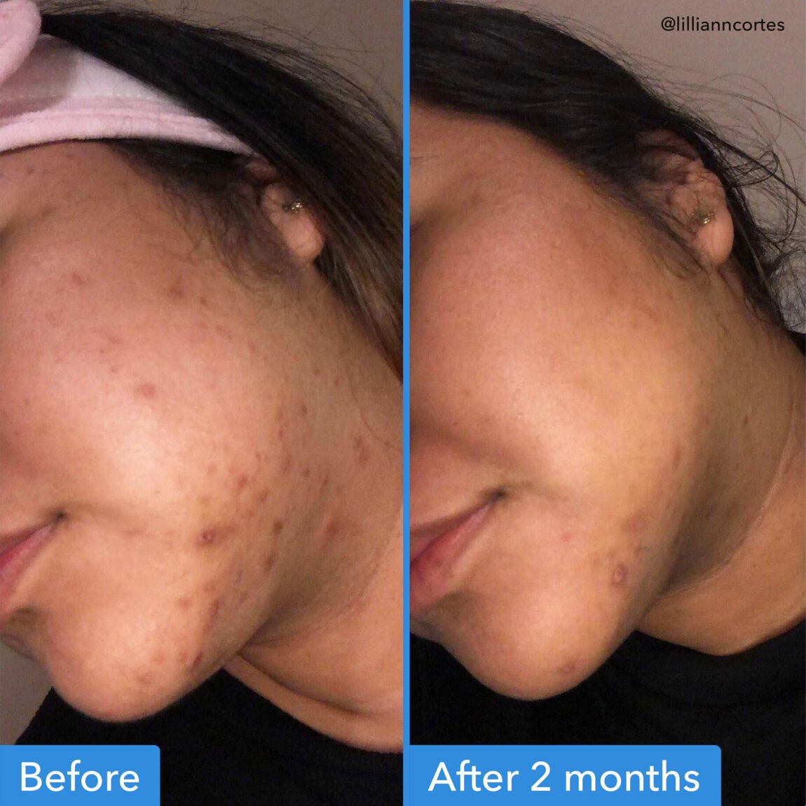 discoloration-correcting-serum-y4 zb_p.jpg
